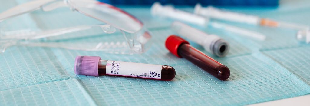 Pet purple and red top test tubes.